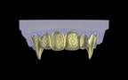 Fiendsmith's Maw - Custom Grillz / Tooth Caps