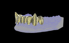 Fiendsmith's Maw - Custom Grillz / Tooth Caps
