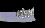 Fiendsmith's Maw - Custom Grillz / Tooth Caps