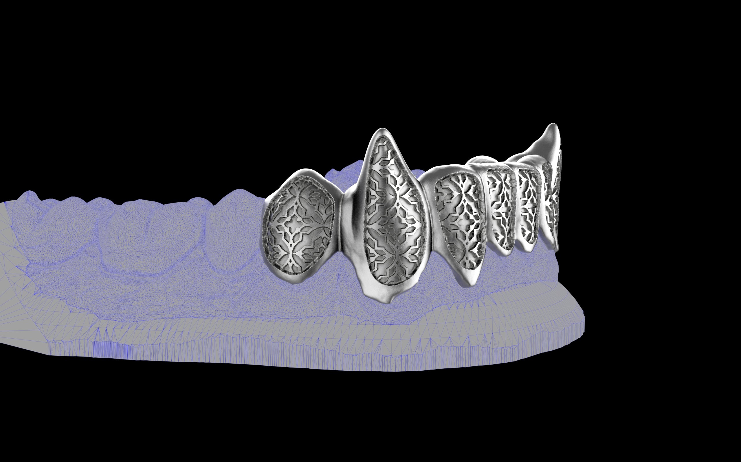Fiendsmith's Maw - Custom Grillz / Tooth Caps