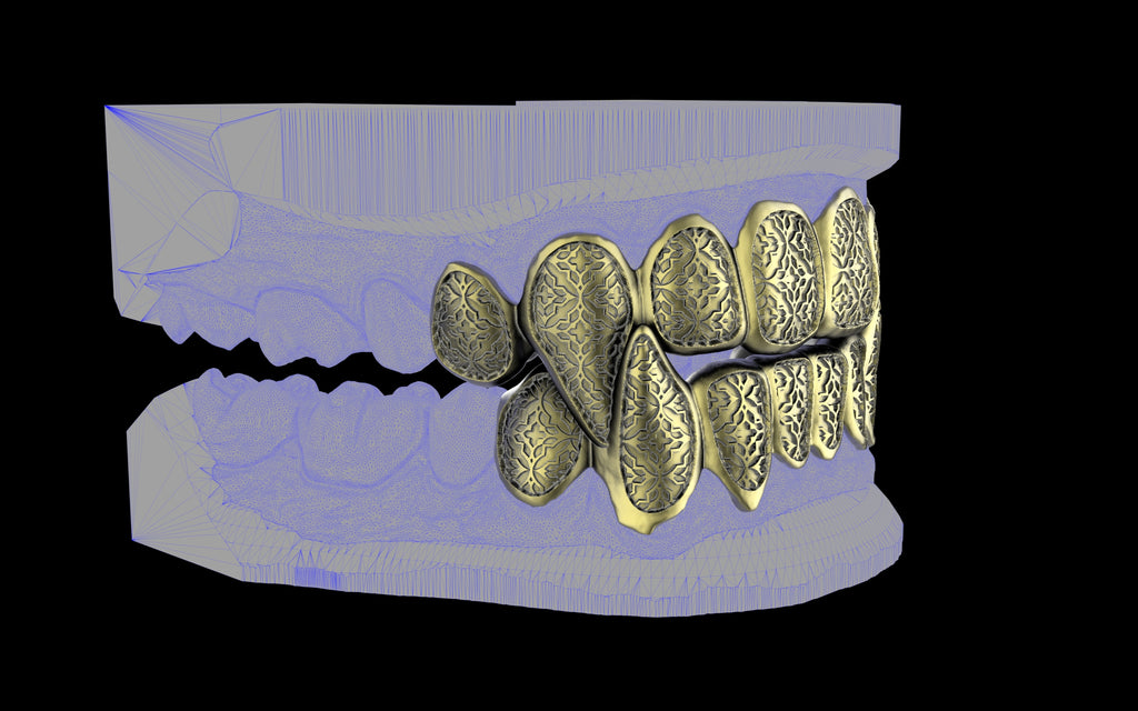 Fiendsmith's Maw - Custom Grillz / Tooth Caps