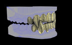 Fiendsmith's Maw - Custom Grillz / Tooth Caps