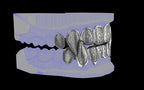 Fiendsmith's Maw - Custom Grillz / Tooth Caps