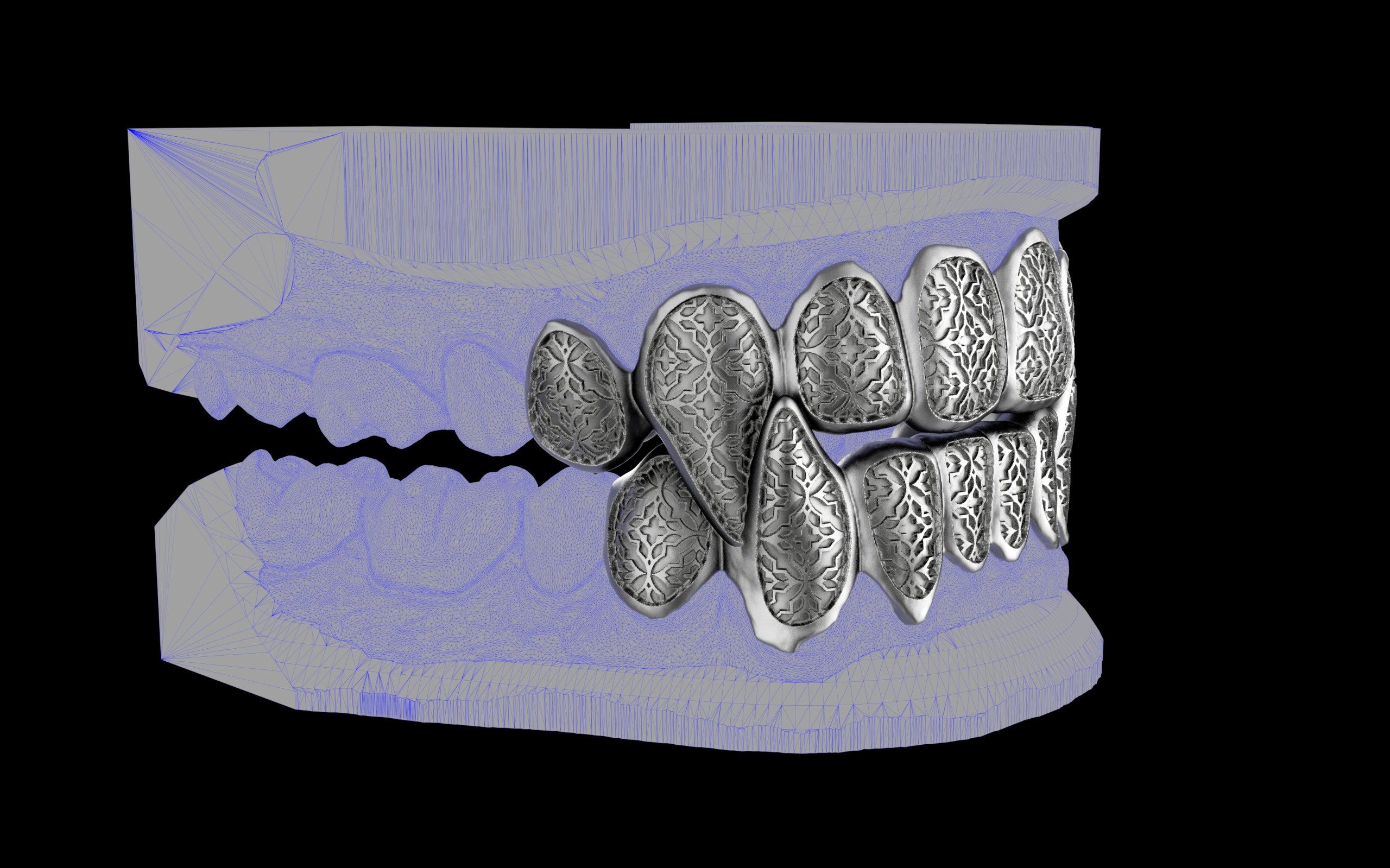 Fiendsmith's Maw - Custom Grillz / Tooth Caps