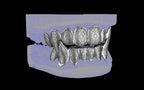 Fiendsmith's Maw - Custom Grillz / Tooth Caps
