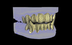 Fiendsmith's Maw - Custom Grillz / Tooth Caps