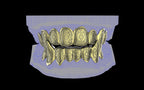 Fiendsmith's Maw - Custom Grillz / Tooth Caps