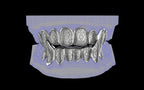 Fiendsmith's Maw - Custom Grillz / Tooth Caps