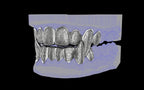 Fiendsmith's Maw - Custom Grillz / Tooth Caps