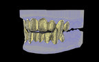 Fiendsmith's Maw - Custom Grillz / Tooth Caps