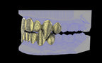 Fiendsmith's Maw - Custom Grillz / Tooth Caps