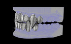 Fiendsmith's Maw - Custom Grillz / Tooth Caps