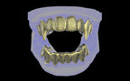 Fiendsmith's Maw - Custom Grillz / Tooth Caps