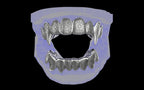 Fiendsmith's Maw - Custom Grillz / Tooth Caps