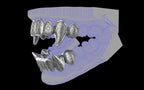 Fiendsmith's Maw - Custom Grillz / Tooth Caps