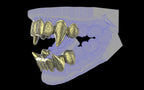 Fiendsmith's Maw - Custom Grillz / Tooth Caps