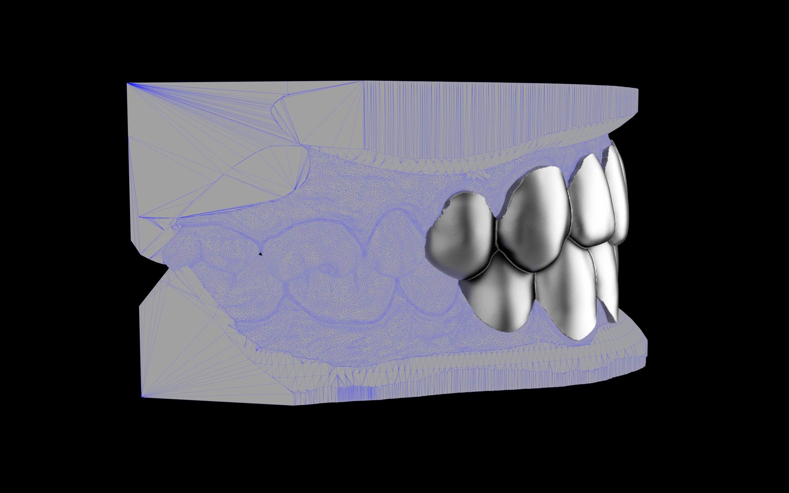 Custom Grillz & Tooth Caps - Plain Jane