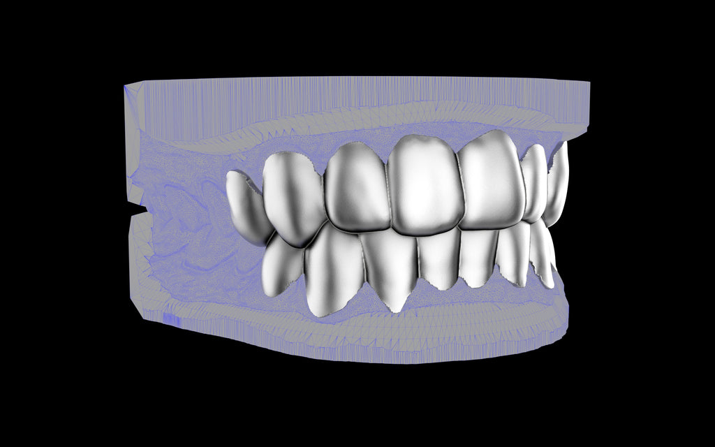 Custom Grillz & Tooth Caps - Plain Jane