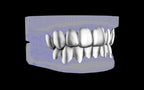 Custom Grillz & Tooth Caps - Plain Jane