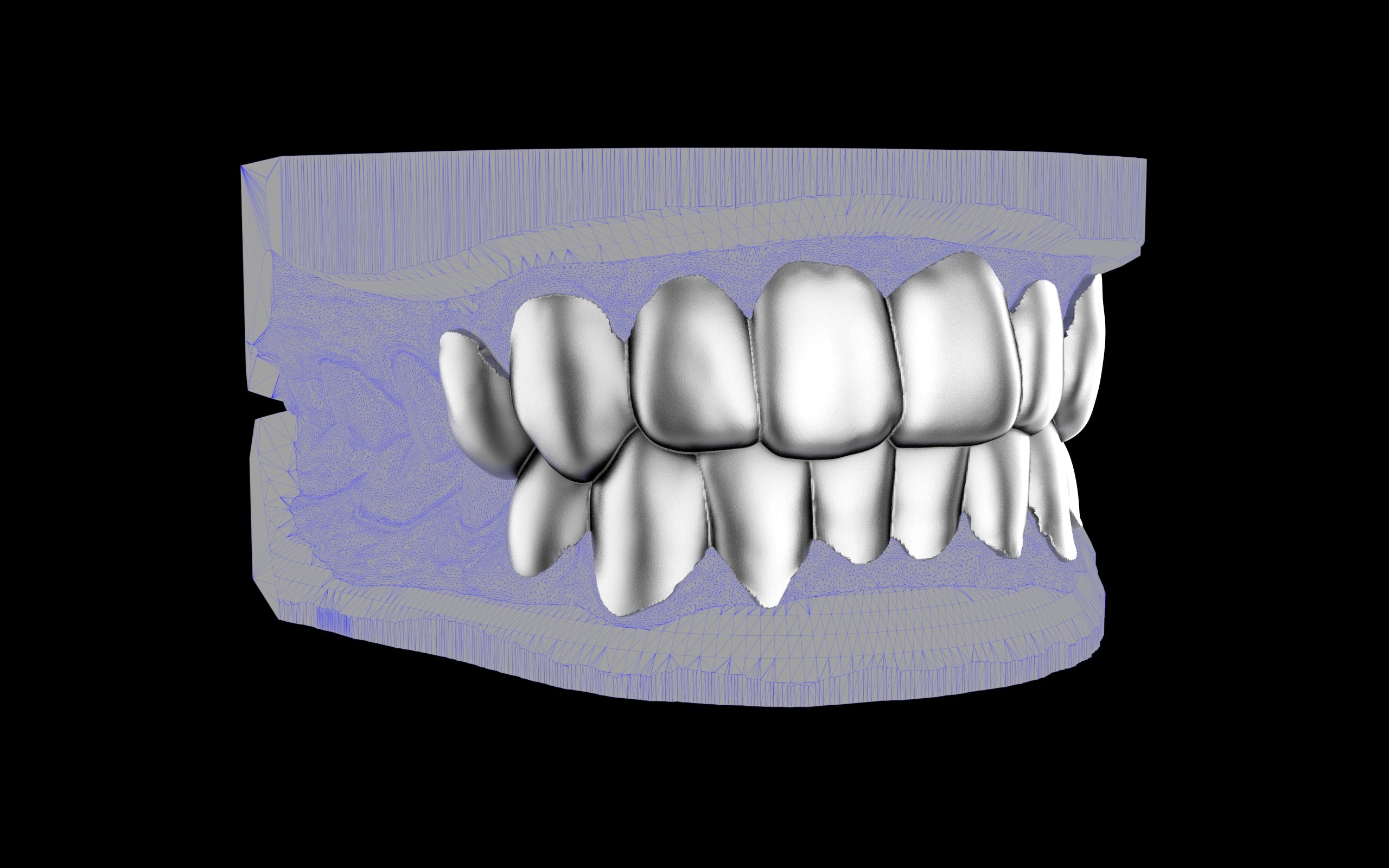 Custom Grillz & Tooth Caps - Plain Jane