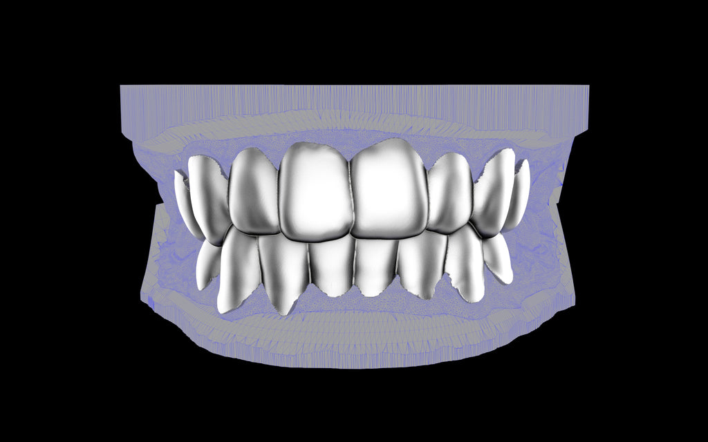 Custom Grillz & Tooth Caps - Plain Jane