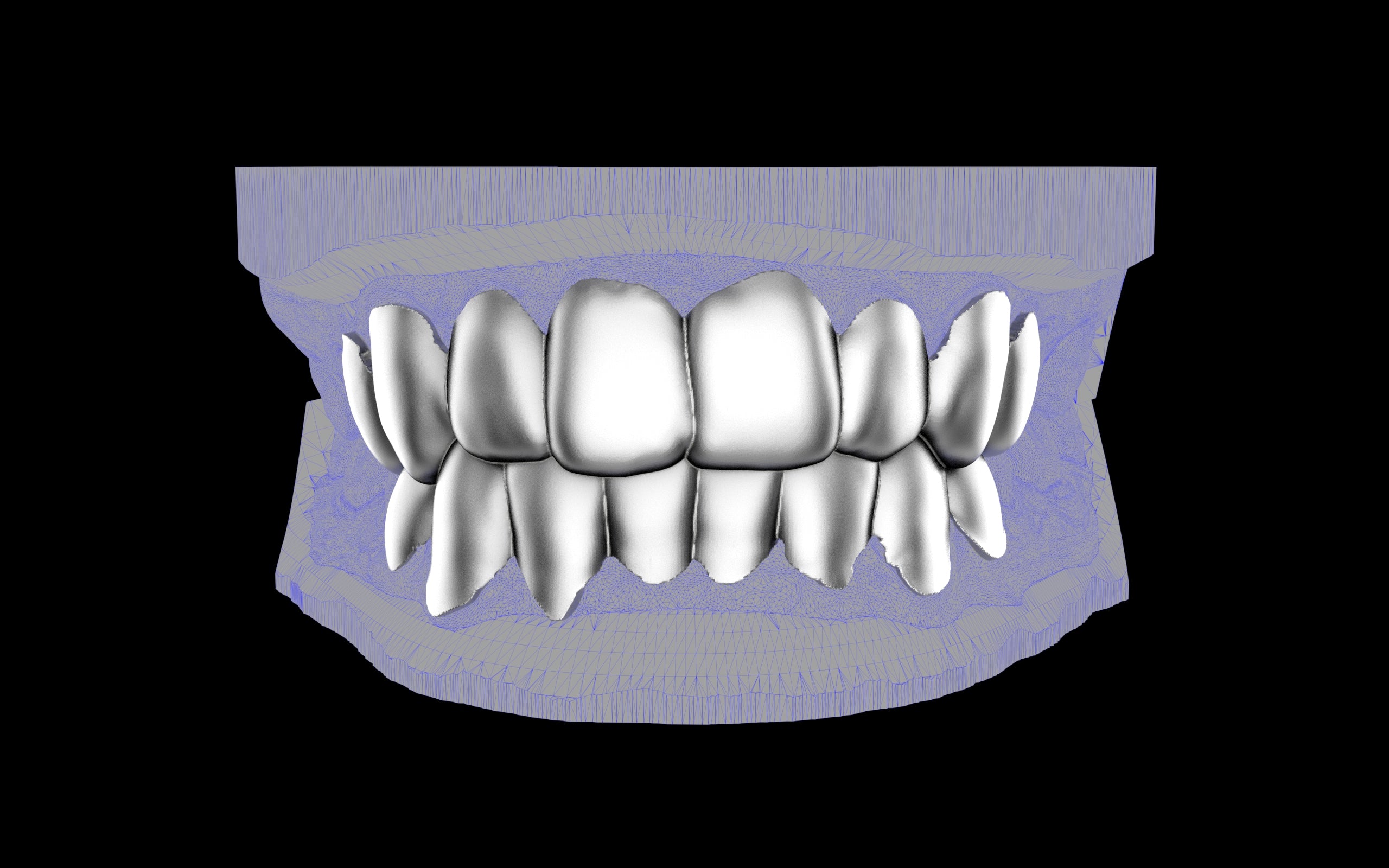 Custom Grillz & Tooth Caps - Plain Jane