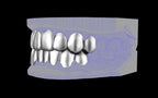 Custom Grillz & Tooth Caps - Plain Jane
