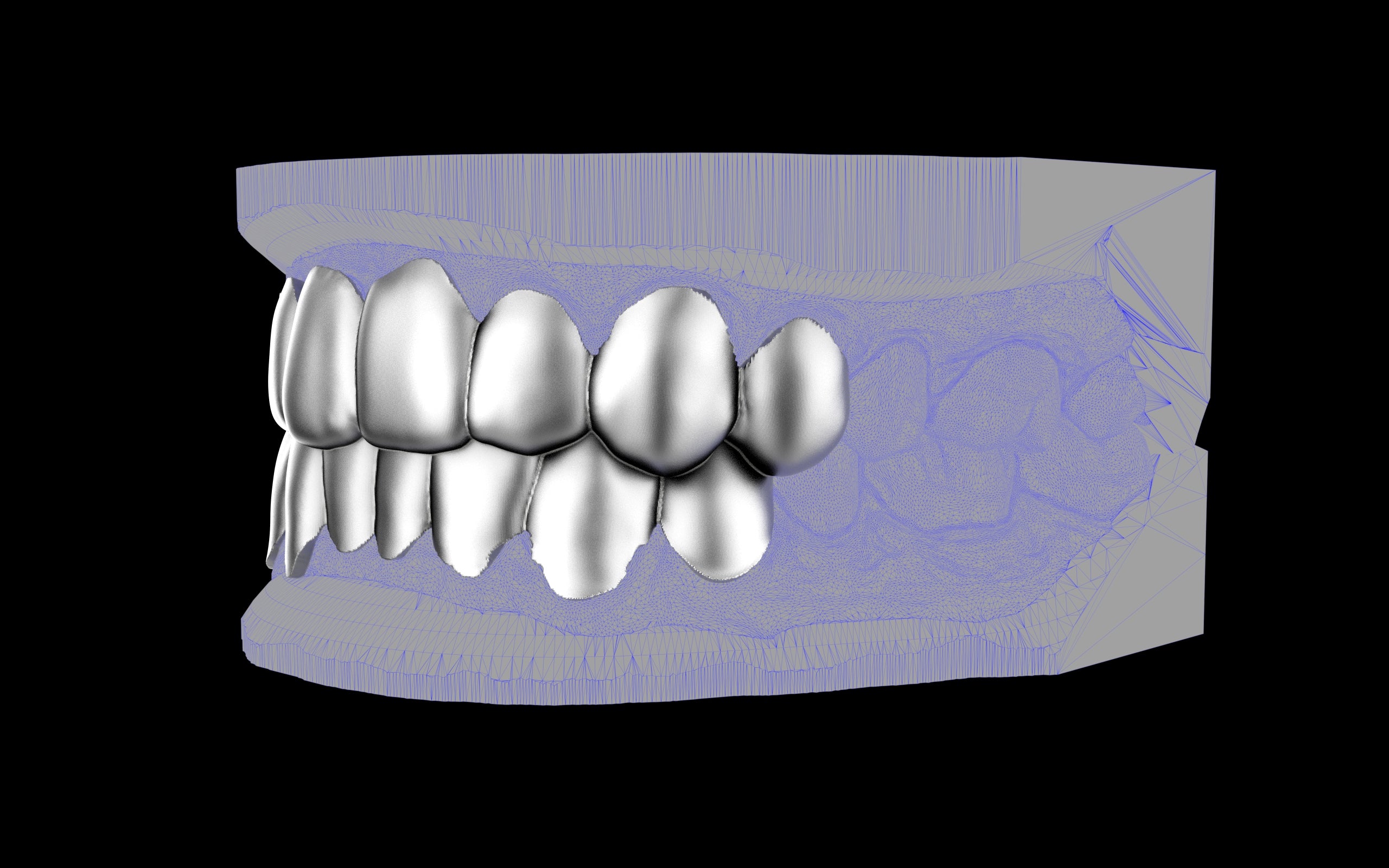Custom Grillz & Tooth Caps - Plain Jane