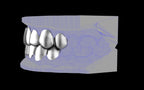 Custom Grillz & Tooth Caps - Plain Jane