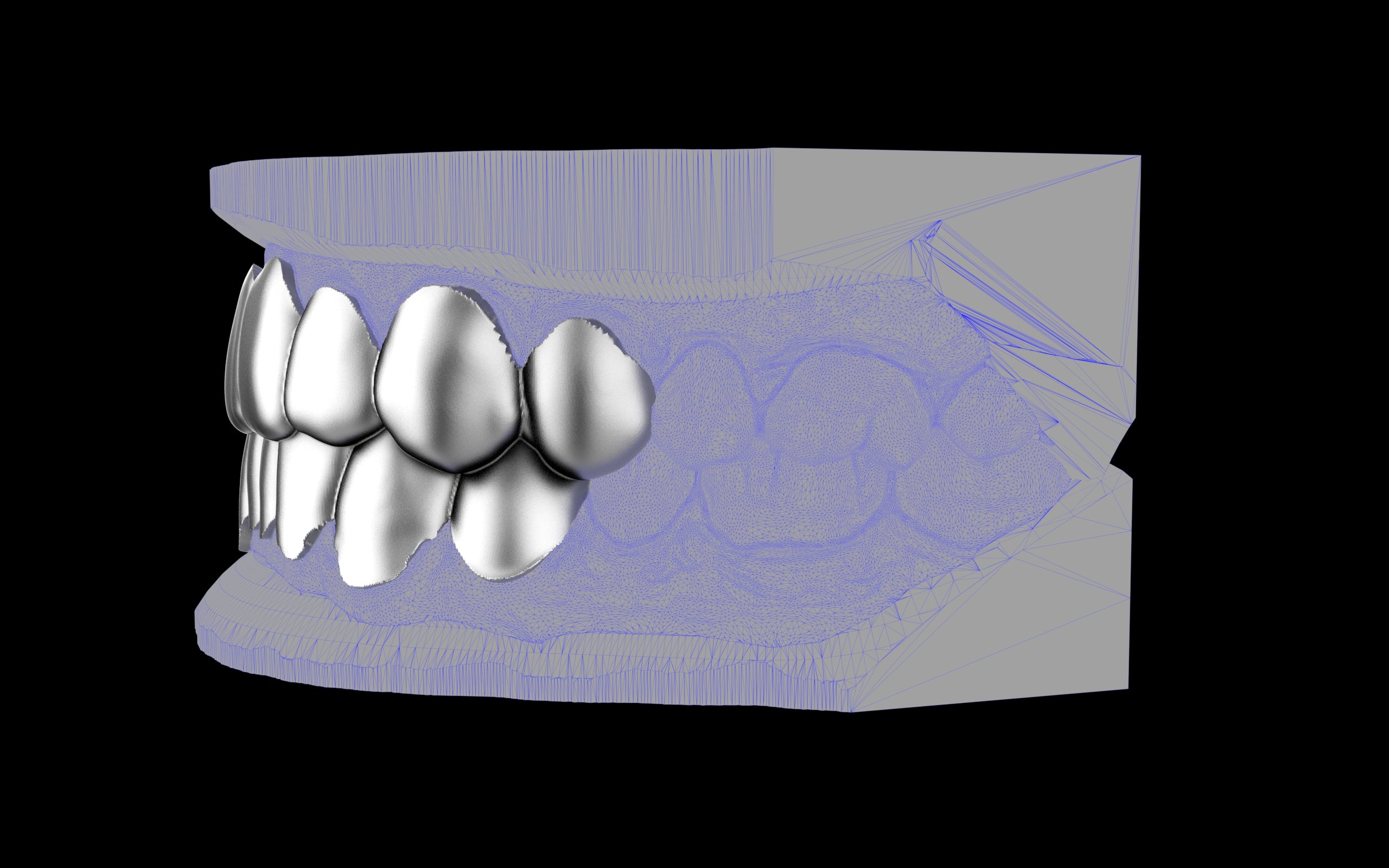 Custom Grillz & Tooth Caps - Plain Jane