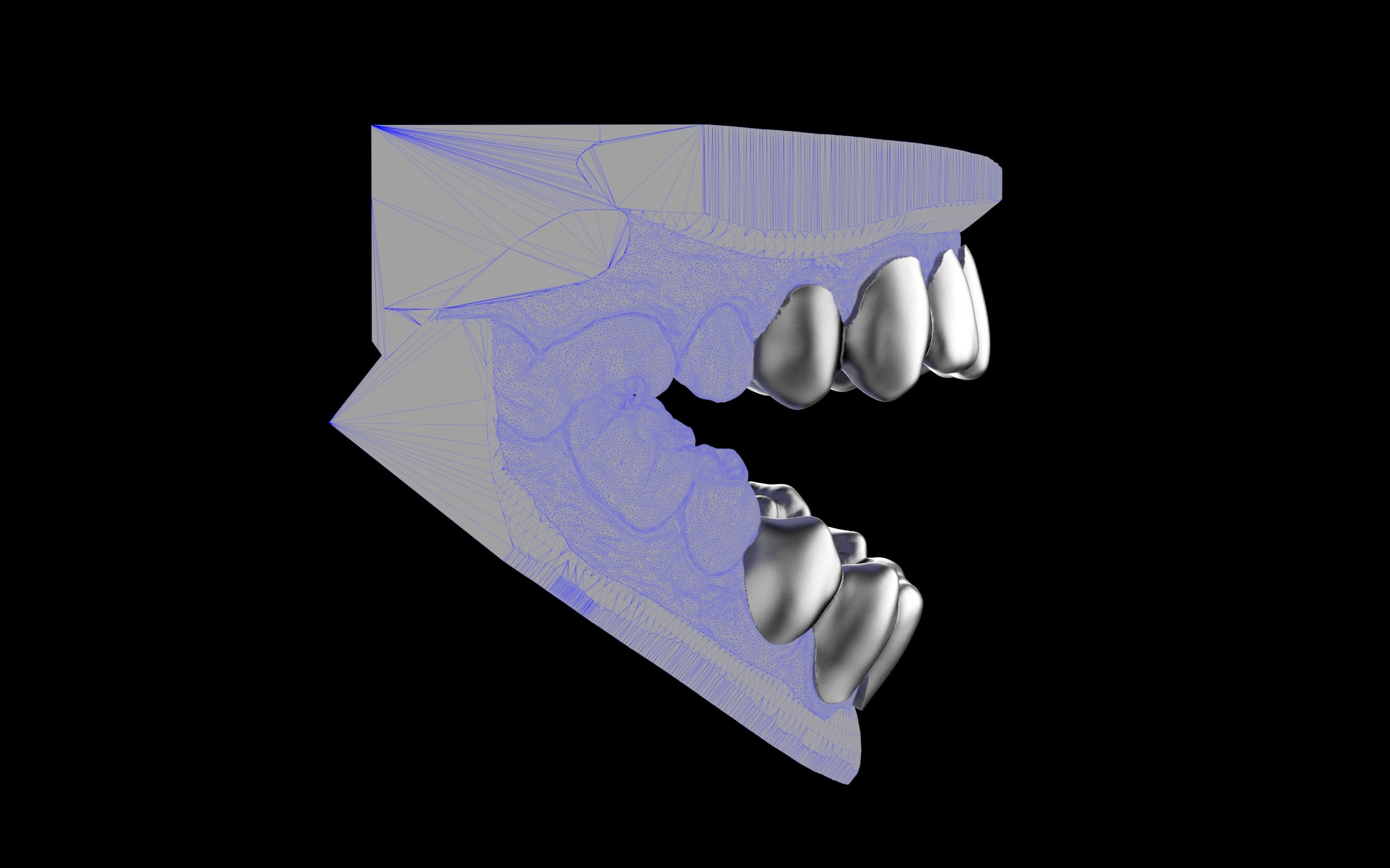 Custom Grillz & Tooth Caps - Plain Jane