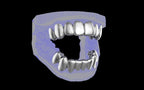 Custom Grillz & Tooth Caps - Plain Jane