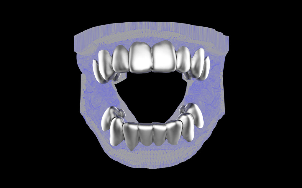 Custom Grillz & Tooth Caps - Plain Jane