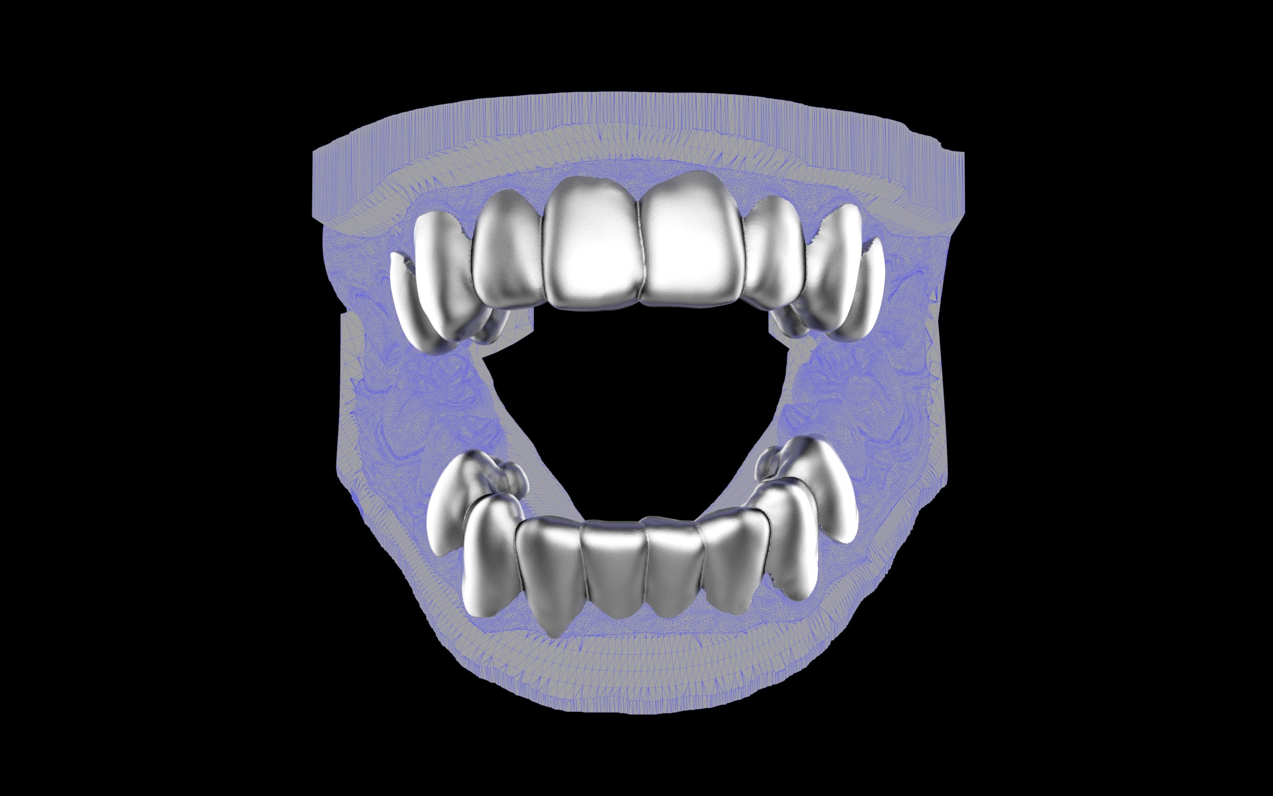 Custom Grillz & Tooth Caps - Plain Jane