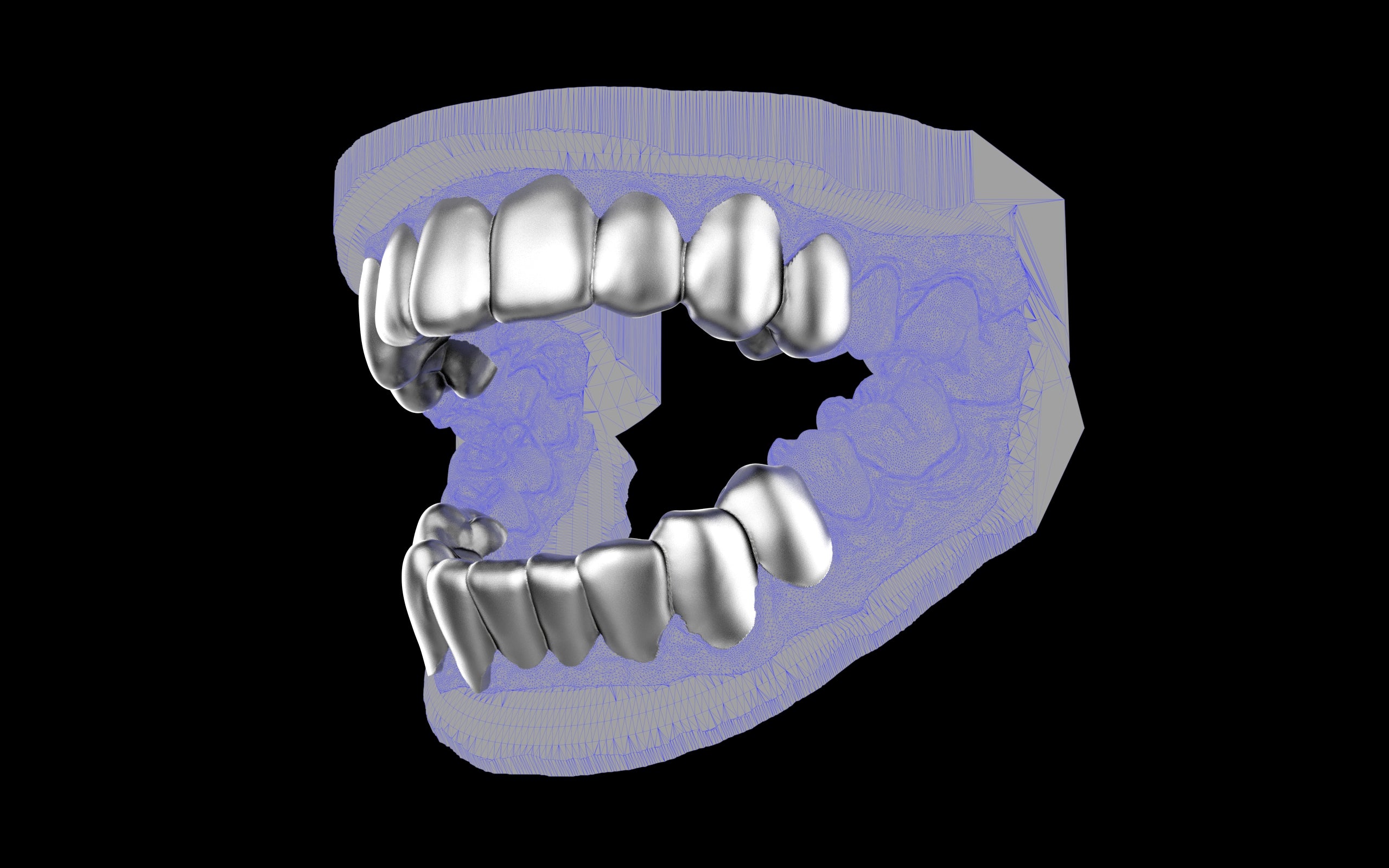 Custom Grillz & Tooth Caps - Plain Jane