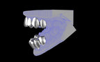 Custom Grillz & Tooth Caps - Plain Jane