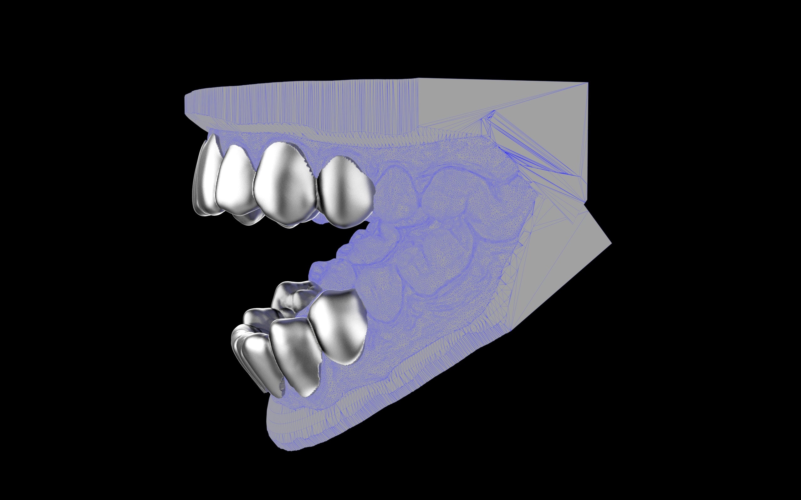 Custom Grillz & Tooth Caps - Plain Jane