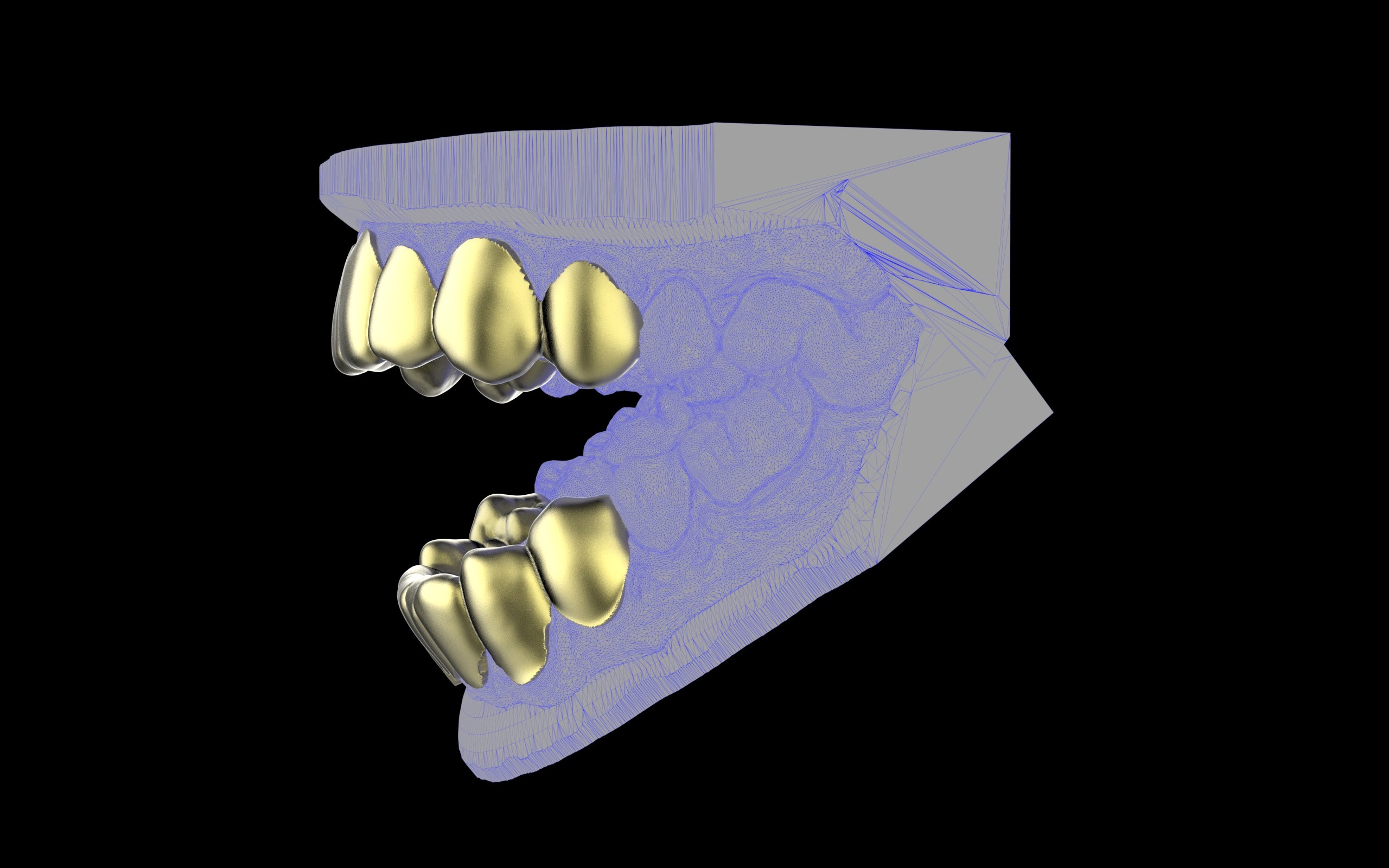 Custom Grillz & Tooth Caps - Plain Jane