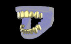 Custom Grillz & Tooth Caps - Plain Jane