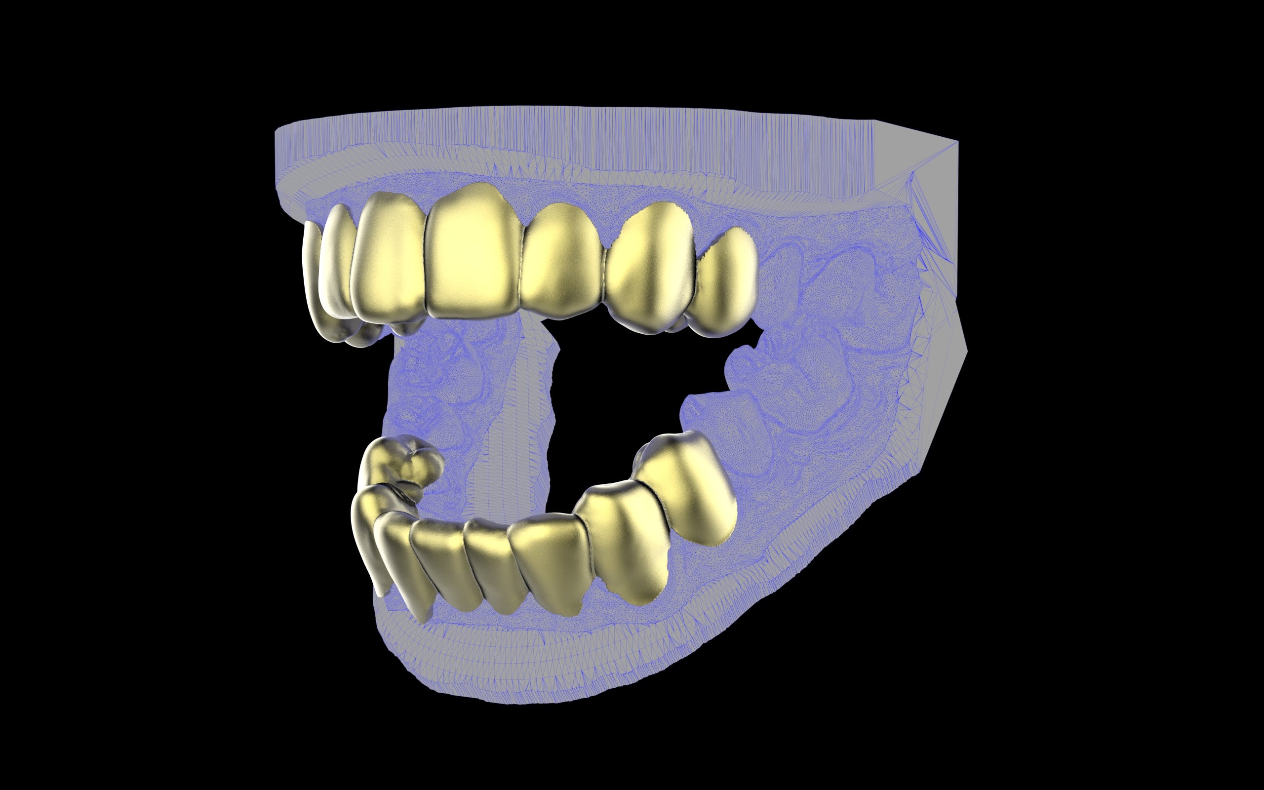 Custom Grillz & Tooth Caps - Plain Jane