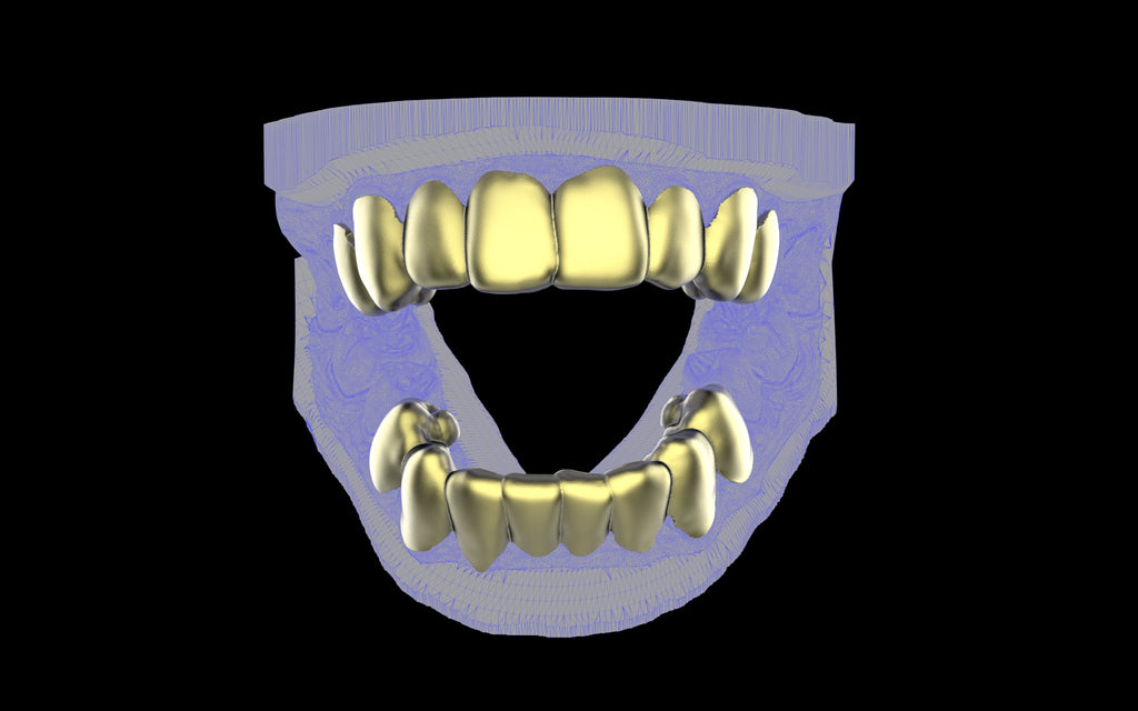 Custom Grillz & Tooth Caps - Plain Jane