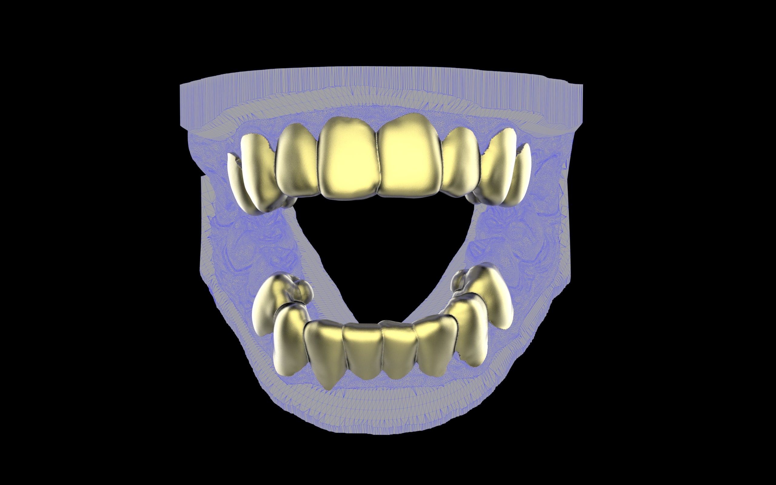 Custom Grillz & Tooth Caps - Plain Jane