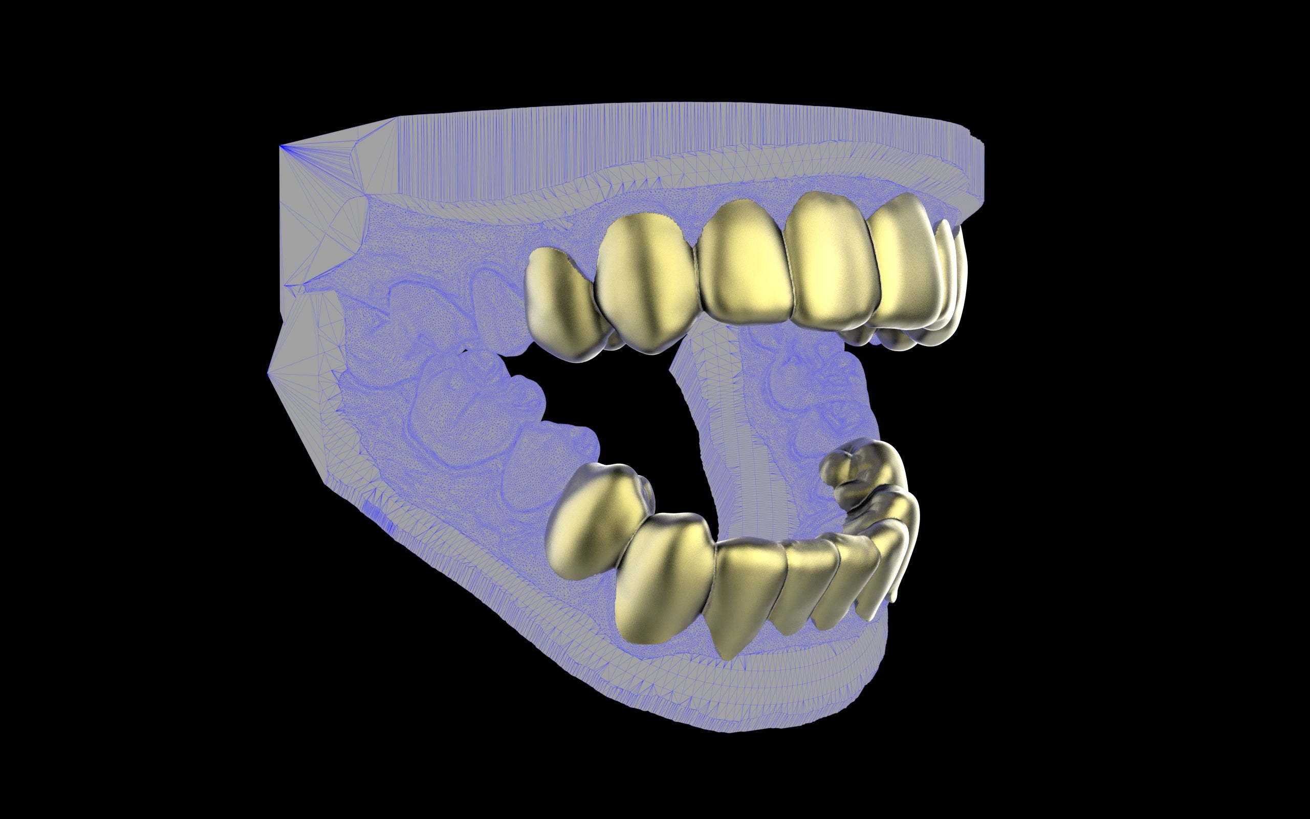 Custom Grillz & Tooth Caps - Plain Jane