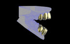 Custom Grillz & Tooth Caps - Plain Jane