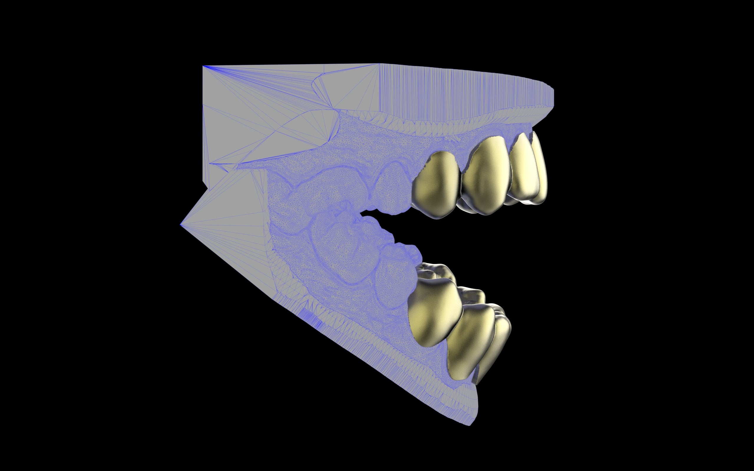 Custom Grillz & Tooth Caps - Plain Jane