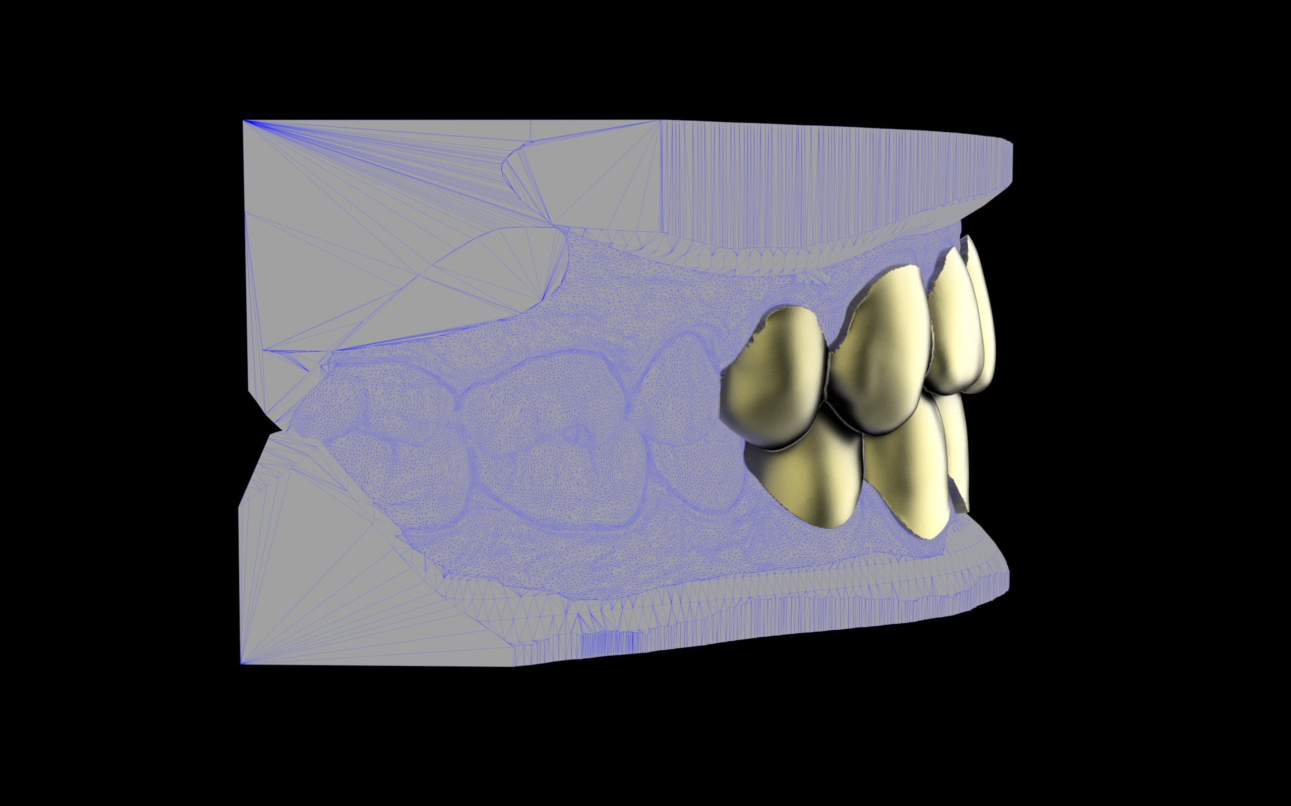 Custom Grillz & Tooth Caps - Plain Jane