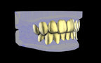 Custom Grillz & Tooth Caps - Plain Jane