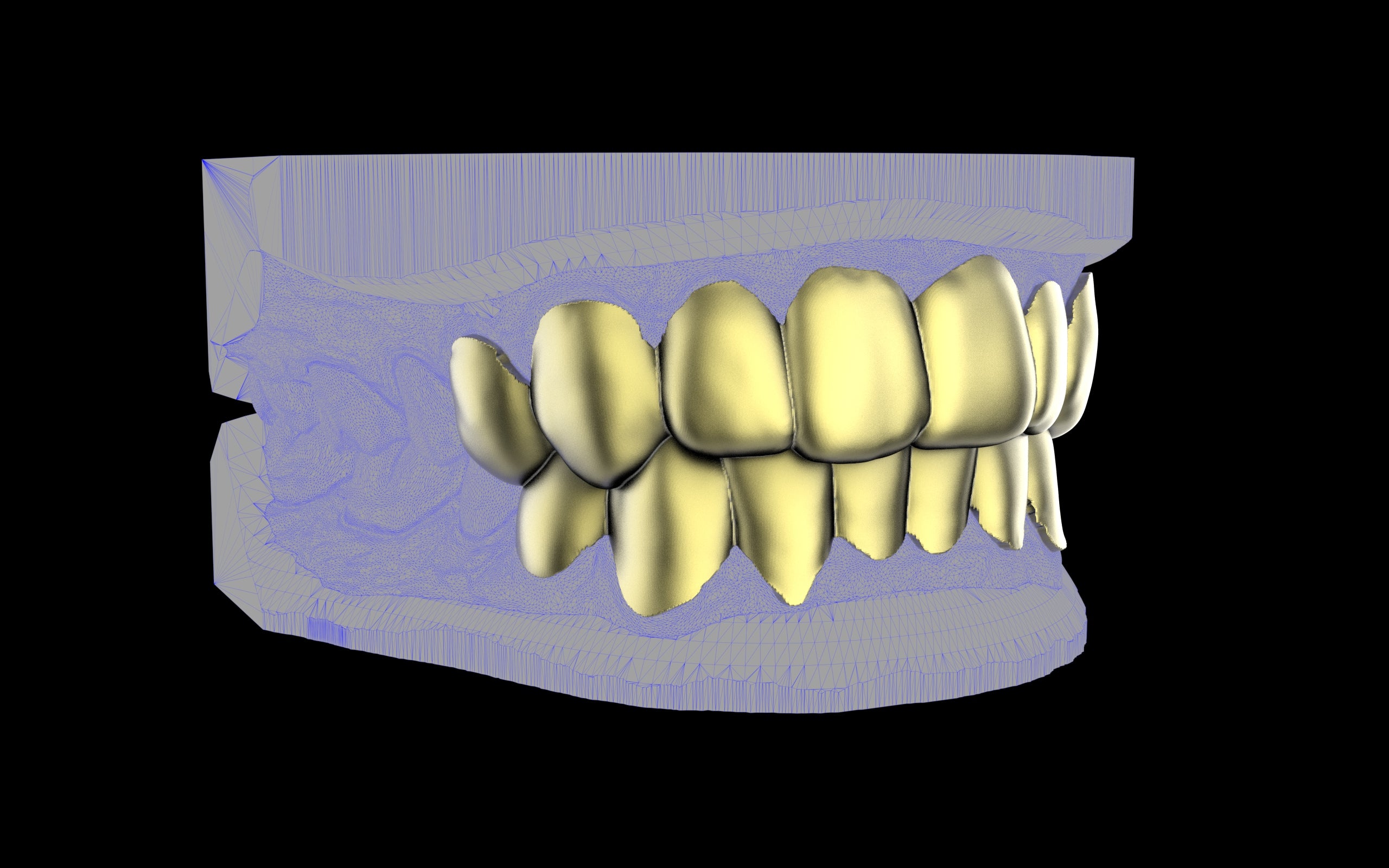 Custom Grillz & Tooth Caps - Plain Jane