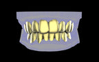 Custom Grillz & Tooth Caps - Plain Jane