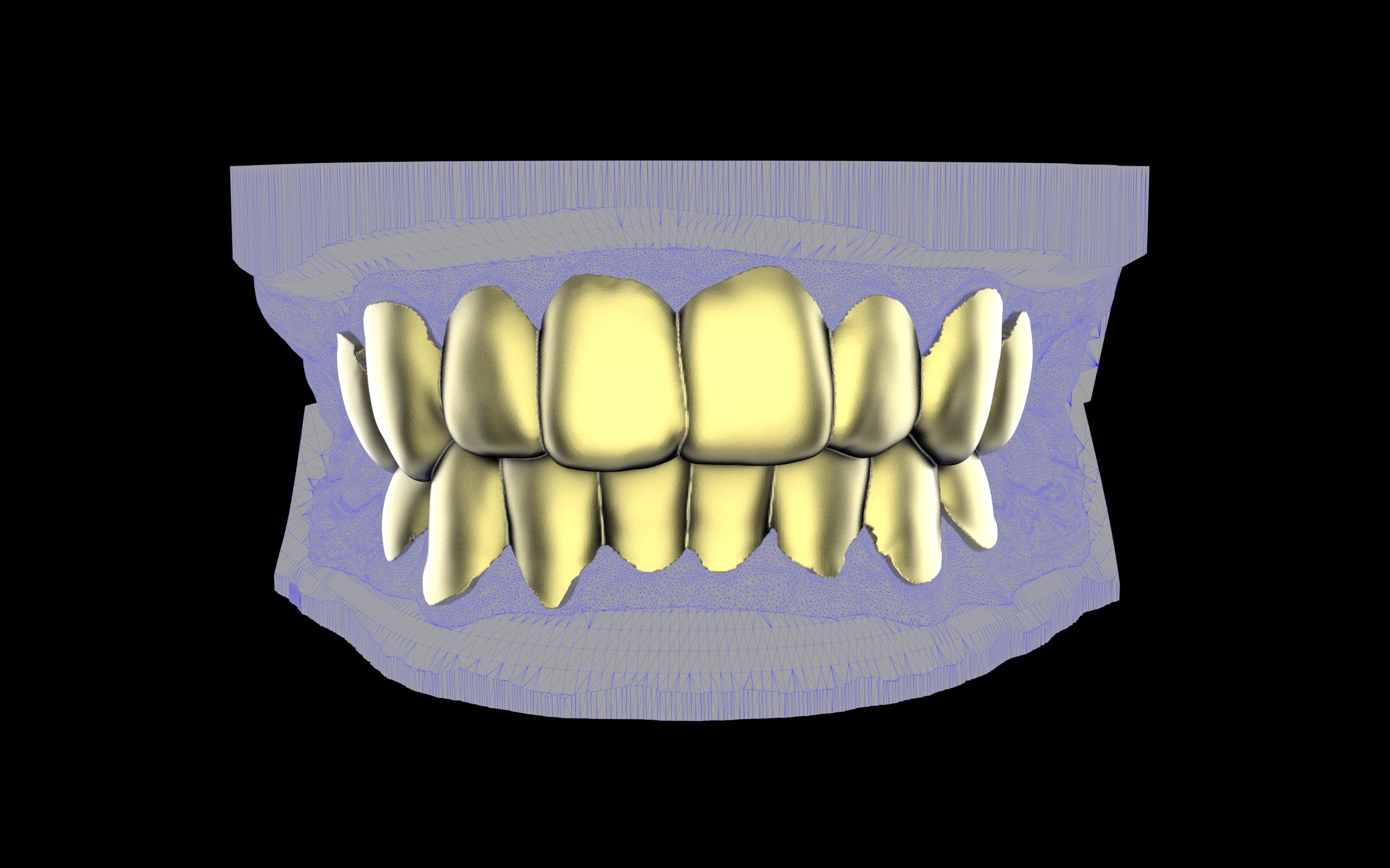 Custom Grillz & Tooth Caps - Plain Jane